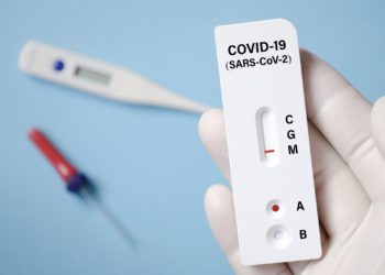 Havacılık toparlanma için hızlı testi bekliyor